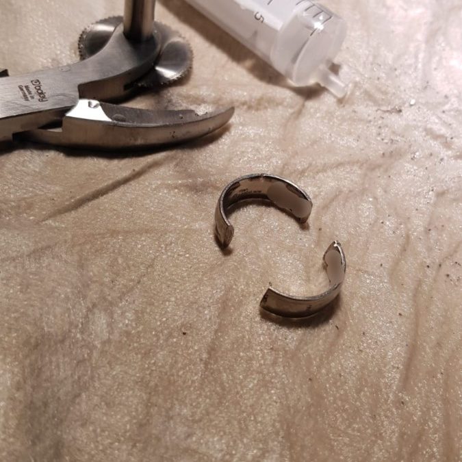 Hilfeleistung – Ring vom Finger entfernen