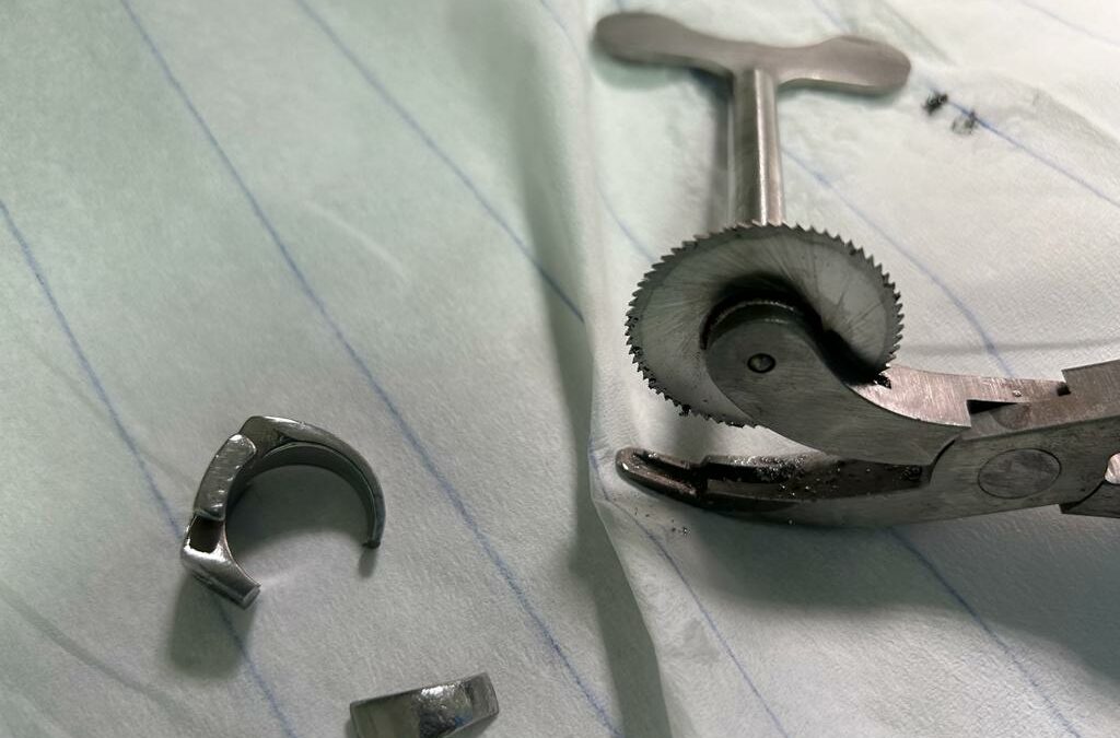 Hilfeleistung – Ring entfernen